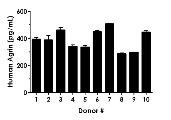 Sandwich ELISA - Human Agrin ELISA Kit (AB216945)