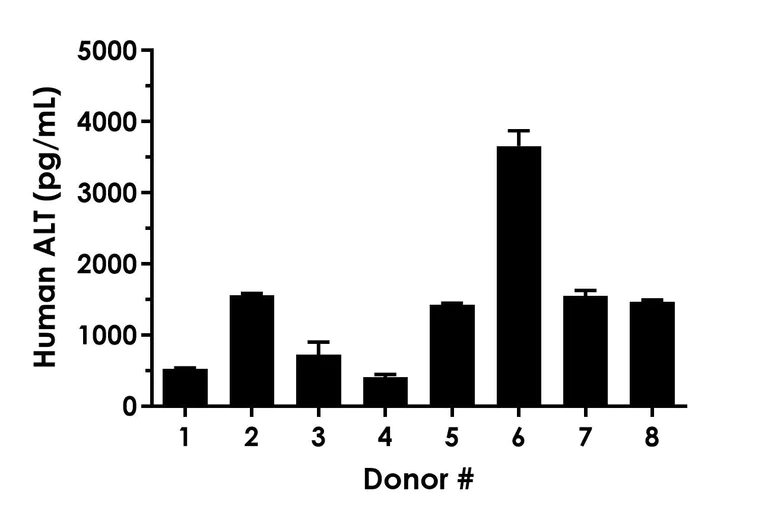 Sandwich ELISA - Human Alanine aminotransferase (ALT) ELISA Kit, Chemiluminescent (AB325365)