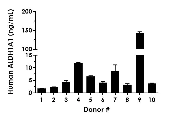 Sandwich ELISA - Human ALDH1A1 ELISA Kit (AB214024)