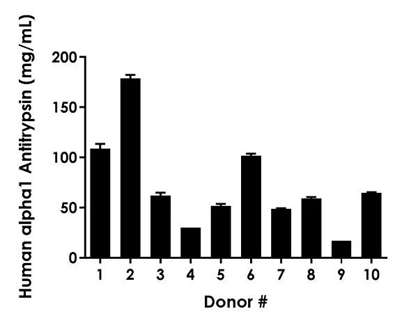 Sandwich ELISA - Human alpha 1 Antitrypsin ELISA Kit, Fluorescent (AB229417)