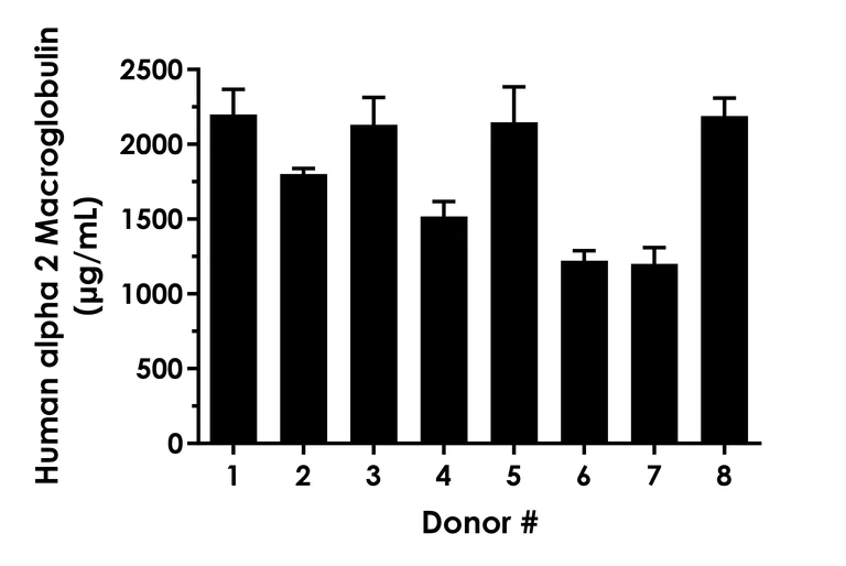 Sandwich ELISA - Human alpha 2 Macroglobulin ELISA Kit (AB322431)