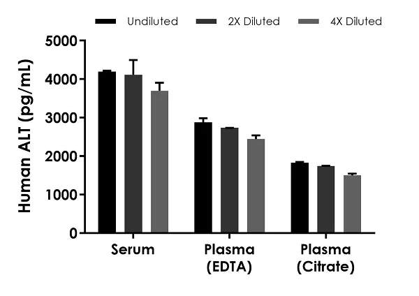 Sandwich ELISA - Human ALT ELISA Kit (AB234578)