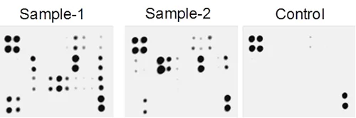 Multiplex Protein Detection - Human Angiogenesis Antibody Array - Membrane (20 Targets) (AB134000)