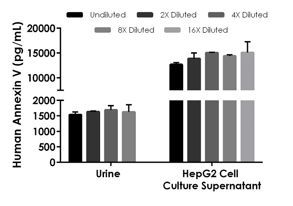 Sandwich ELISA - Human Annexin V ELISA Kit (AB223863), expandable thumbnail