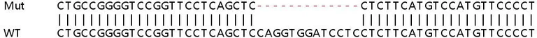 Sanger Sequencing - Human ANP32B (PHAPI2/APRIL) knockout HEK-293T cell lysate (AB257831)