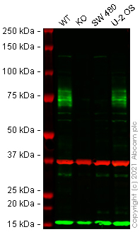Western blot - Human ANTXR1 (TEM8/ATR) knockout HeLa cell lysate (AB257350), expandable thumbnail