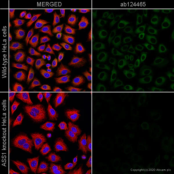 Immunocytochemistry/ Immunofluorescence - Human ASS1 knockout HeLa cell line (AB264989)