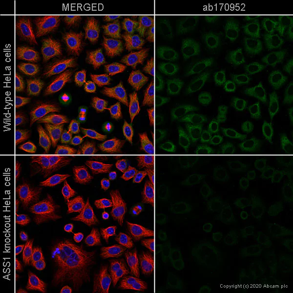 Immunocytochemistry/ Immunofluorescence - Human ASS1 knockout HeLa cell line (AB264989)