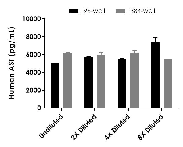 Sandwich ELISA - Human AST ELISA Kit (Aspartate Aminotransferase) (AB263881)