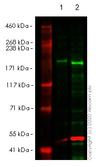 Western blot - Human ATAD2 knockout HeLa cell line (AB264957), expandable thumbnail