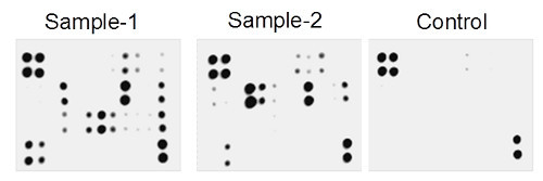 Multiplex Protein Detection - Human Atherosclerosis Antibody Array - Membrane (20 targets) (AB169803), expandable thumbnail