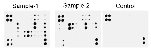 Multiplex Protein Detection - Human Atherosclerosis Antibody Array - Membrane (20 targets) (AB169803)