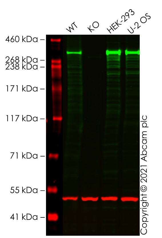 Western blot - Human ATM knockout A549 cell line (AB276095), expandable thumbnail