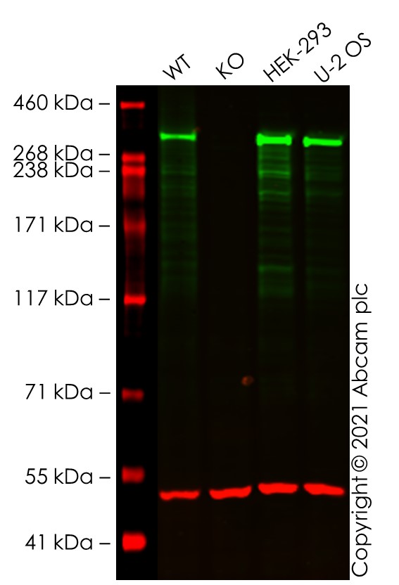 Western blot - Human ATM knockout A549 cell line (AB276095), expandable thumbnail