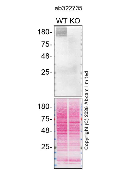 Western blot - Human ATP13A2 knockout HEK-293 cell lysate (AB274983)
