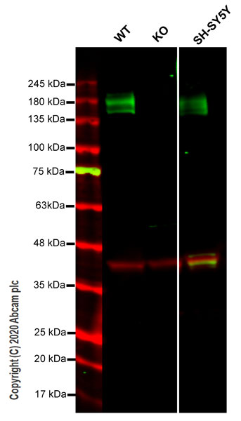 Western blot - Human ATP2B4 (Calcium Pump PMCA4 ATPase) knockout HeLa cell line (AB264720)