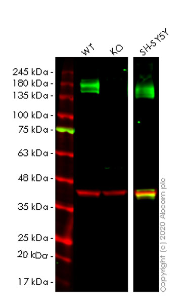 Western blot - Human ATP2B4 (Calcium Pump PMCA4 ATPase) knockout HeLa cell lysate (AB258321)