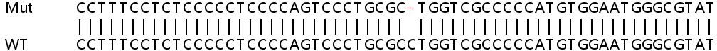 Human ATP5SL knockout HeLa cell lysate