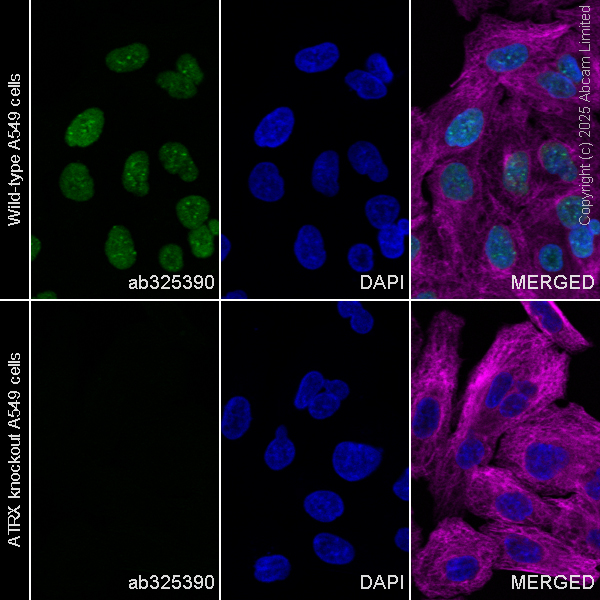 Immunocytochemistry/ Immunofluorescence - Human ATRX knockout A549 cell line (AB287232)