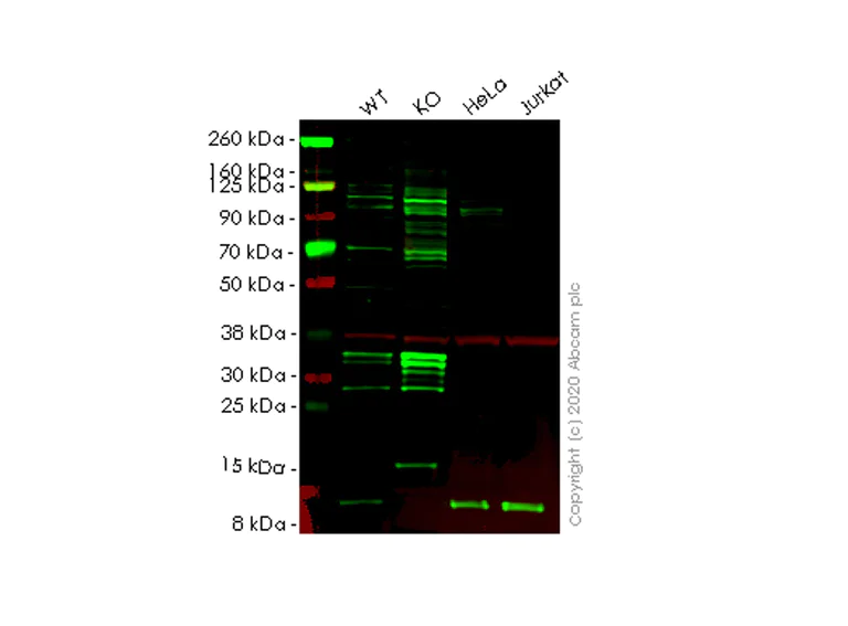 Western blot - Human B2M (beta 2 Microglobulin) knockout Hep G2 cell lysate (AB256846)