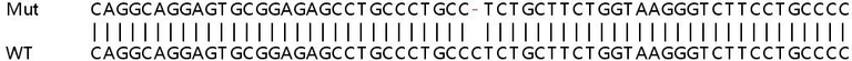 Sanger Sequencing - Human BAK1 (Bak) knockout HeLa cell line (AB265277)