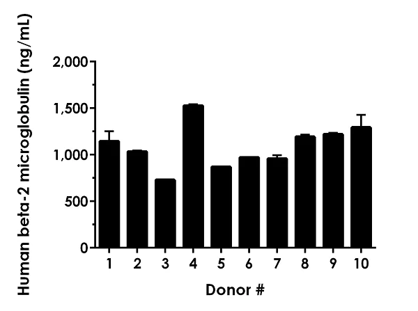 Sandwich ELISA - Human Beta-2-Microglobulin ELISA Kit (AB181423)