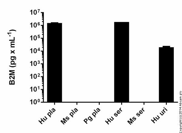 Human beta 2 Microglobulin ELISA Kit (B2M)