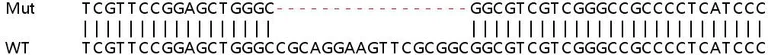 Sanger Sequencing - Human BMP2 knockout HeLa cell line (AB261767)