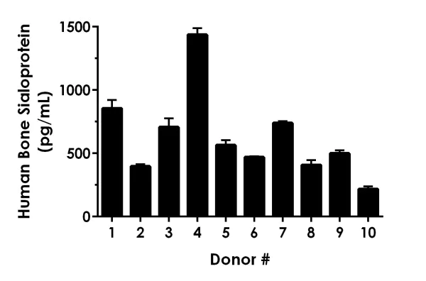 Sandwich ELISA - Human Bone Sialoprotein ELISA Kit (AB277706)