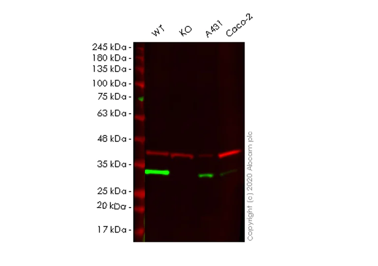 Western blot - Human CA2 (Carbonic anhydrase 2) knockout HEK-293T cell line (AB265072)