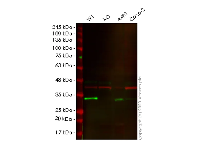 Western blot - Human CA2 (Carbonic anhydrase 2) knockout HEK-293T cell lysate (AB257084)