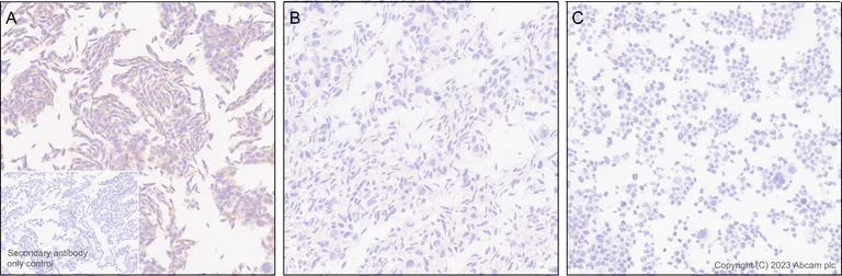 Immunohistochemistry (Formalin/PFA-fixed paraffin-embedded sections) - Human CACNA2D1 (Calcium channel L type DHPR alpha 2 subunit) knockout HeLa cell line (AB265080)