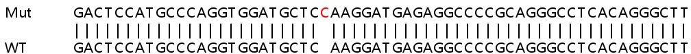 Human CAMKK2 knockout HEK-293T cell line
