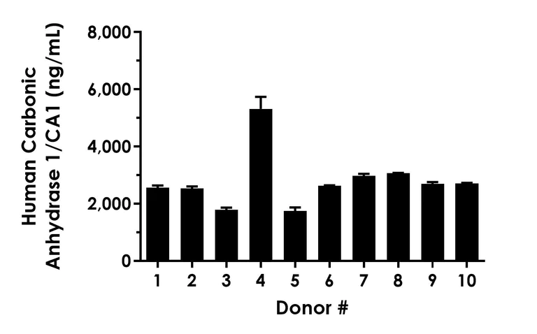 Sandwich ELISA - Human Carbonic Anhydrase 1/CA1 ELISA Kit (AB303755)
