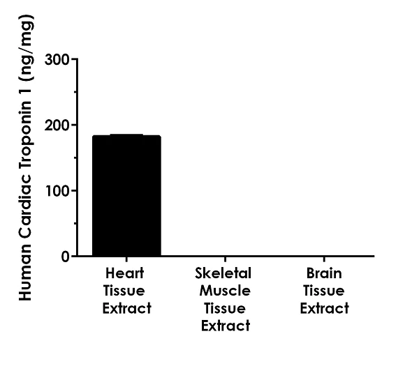 Sandwich ELISA - Human Cardiac Troponin I ELISA Kit (AB200016)