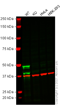 たにひろ様 THP 1ml Human TREM2 knockout THP-1 cell line (ab269489) | Abcam