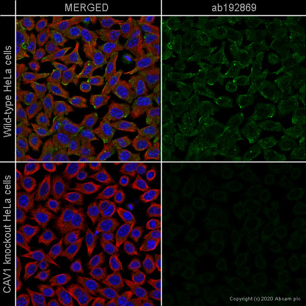 Immunocytochemistry/ Immunofluorescence - Human CAV1 (Caveolin-1) knockout HeLa cell line (AB255371), expandable thumbnail