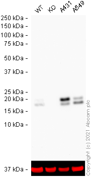 Western blot - Human CAV1 (Caveolin-1) knockout HeLa cell line (AB255371), expandable thumbnail