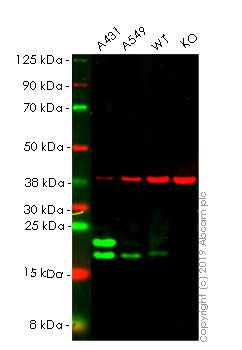 Western blot - Human CAV1 (Caveolin-1) knockout HeLa cell line (AB255371), expandable thumbnail
