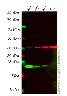 Western blot - Human CAV1 (Caveolin-1) knockout HeLa cell lysate (AB263806)