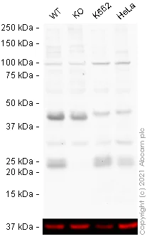 Western blot - Human CBFB knockout A-431 cell lysate (AB270495)