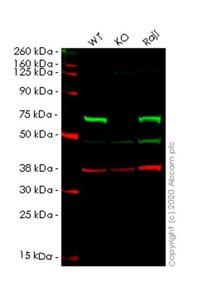 Western blot - Human CBS knockout HeLa cell lysate (AB257203), expandable thumbnail