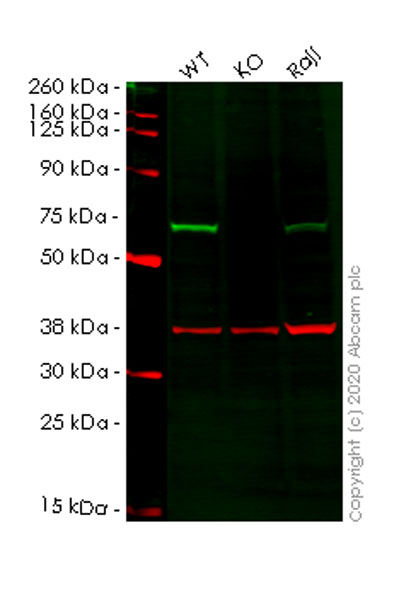 Western blot - Human CBS knockout HeLa cell lysate (AB257203), expandable thumbnail