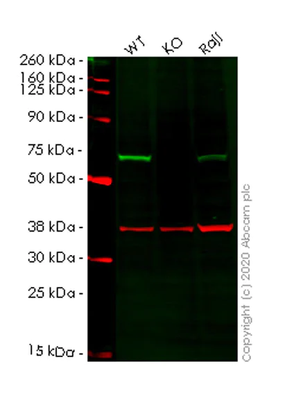 Western blot - Human CBS knockout HeLa cell lysate (AB257203)