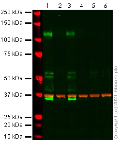 Western blot - Human CD167a/DDR1 knockout MCF7 cell line (AB280048)