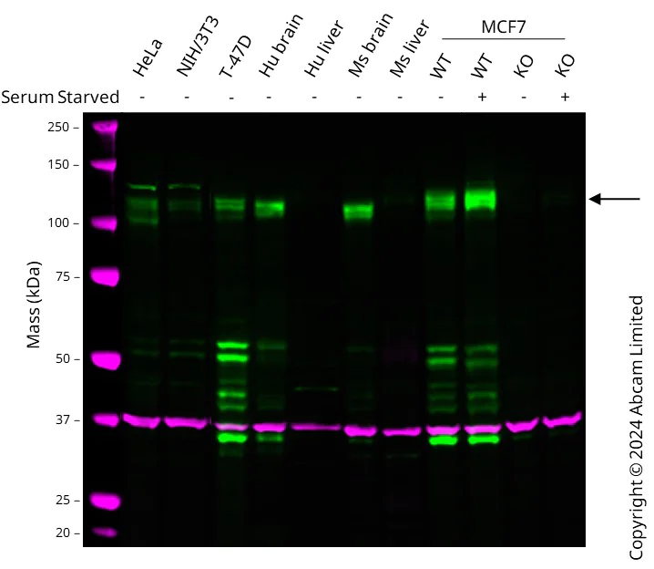 Western blot - Human CD167a/DDR1 knockout MCF7 cell lysate (AB280107)
