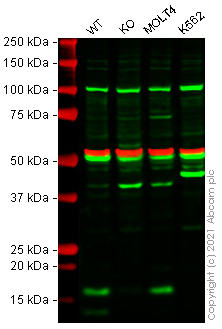 Western blot - Human CD247 knockout Jurkat cell line (AB273856)