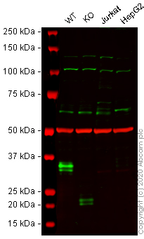 Western blot - Human CD74 knockout Raji cell line (ab273378), expandable thumbnail