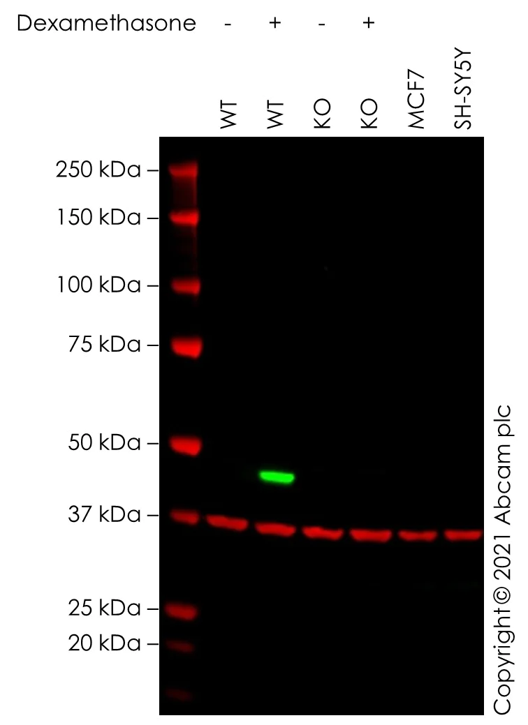 Western blot - Human CDKN1C (p57 Kip2) knockout HeLa cell lysate (AB280120)