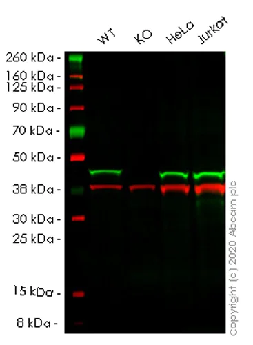 Western blot - Human CECR5 knockout HEK-293T cell lysate (AB257888)